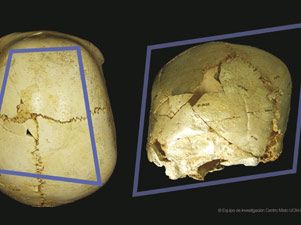 Encuentran en Atapuerca el cráneo de un niño discapacitado