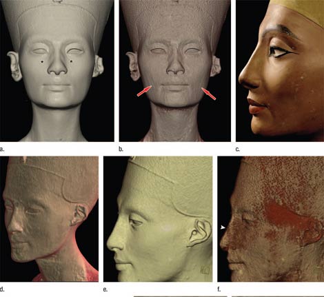Imágenes de tomografía computerizada que muestran el rostro interior (la segunda de arriba, la primera y tercera de abajo) esculpido bajo el busto de Nefertiti. | 'Radiology' Imágenes de tomografía computerizada que muestran el rostro interior (la segunda de arriba, la primera y tercera de abajo) esculpido bajo el busto de Nefertiti. | 'Radiology'