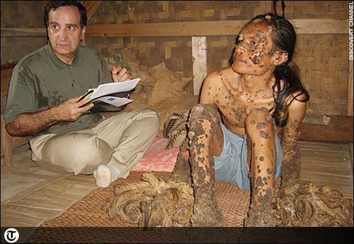http://rienzie.com/img/hombre_arbol.jpg