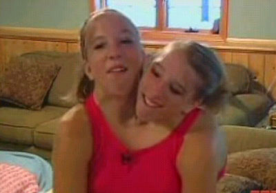 Las Siamesas Abigail y Brittany Hensel